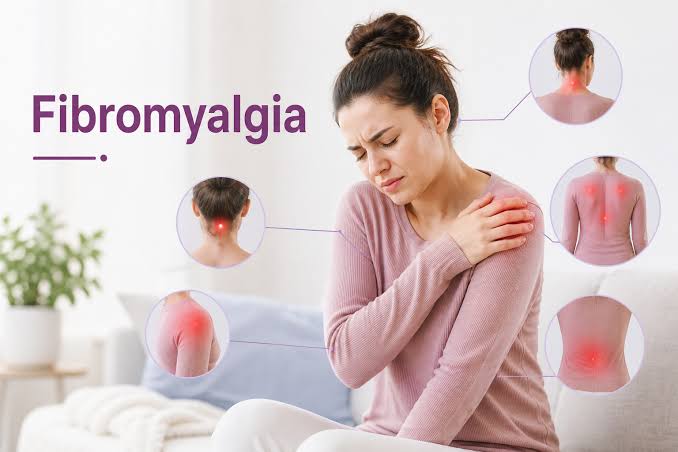 Fibromyalgia